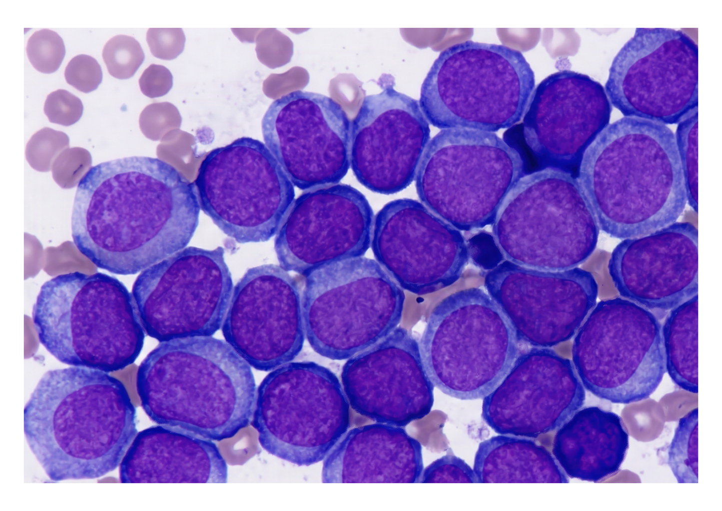 Making cytology work: From lesion to diagnosis (LVS25)
