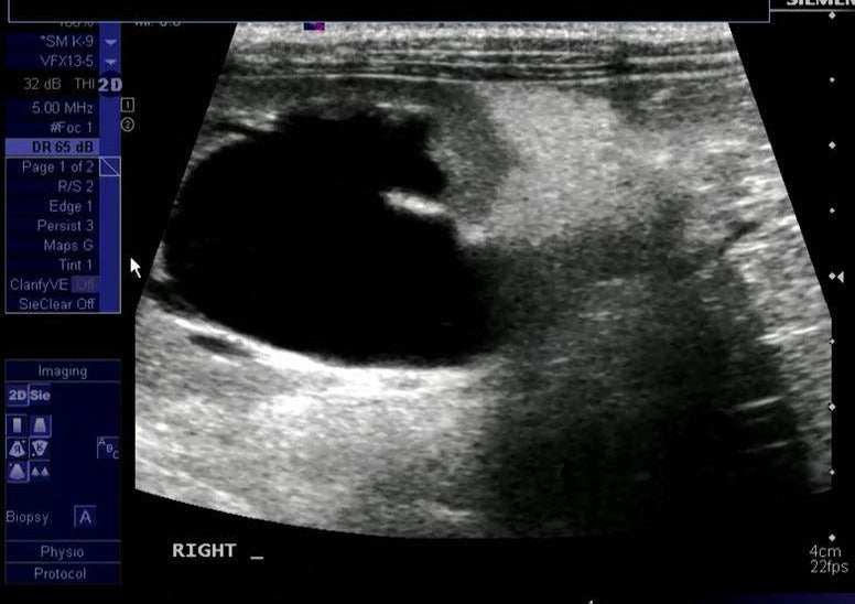 Intermediate/Advanced Ultrasound Pre-Lab Lecture