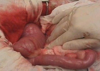 The Essential Guide to GI Obstruction: Diagnosis & Treatment