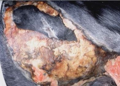 Stratégies de gestion réussie des monticules compliqués