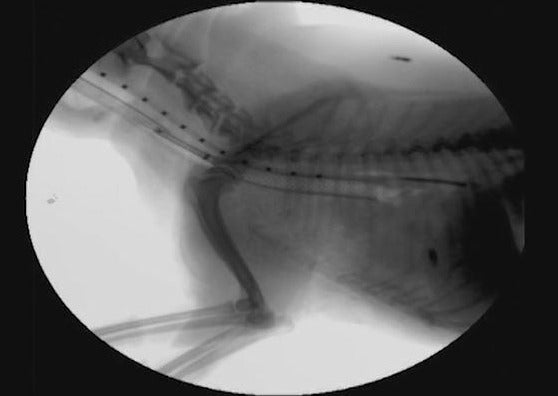 Gestion de l'effondrement de la trachée: au-delà de l'hydrocodone