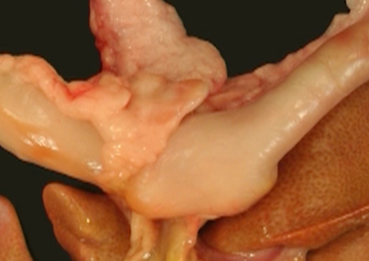 Don't let inflammatory bowel disease be a pain in your ..... day