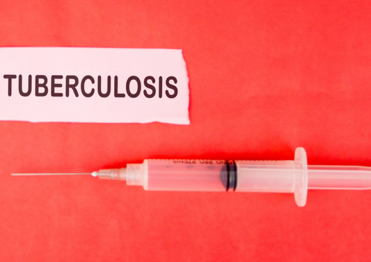 The Trilogy of TB testing - making the three elements work together for a successful test