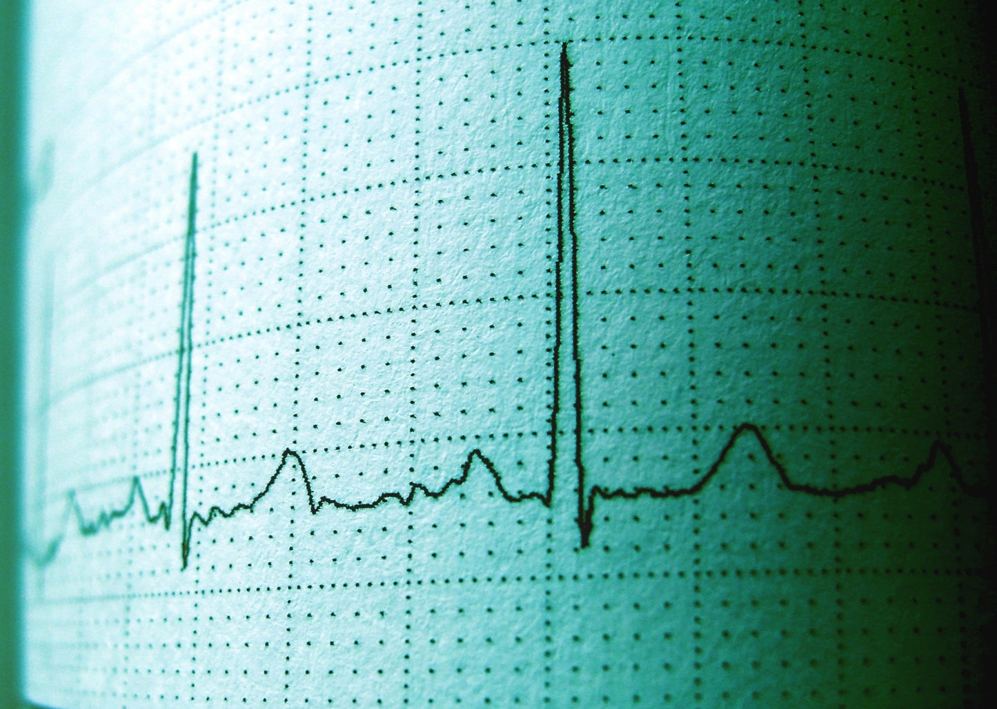 Ride the Wave: ECG Survival Kit
