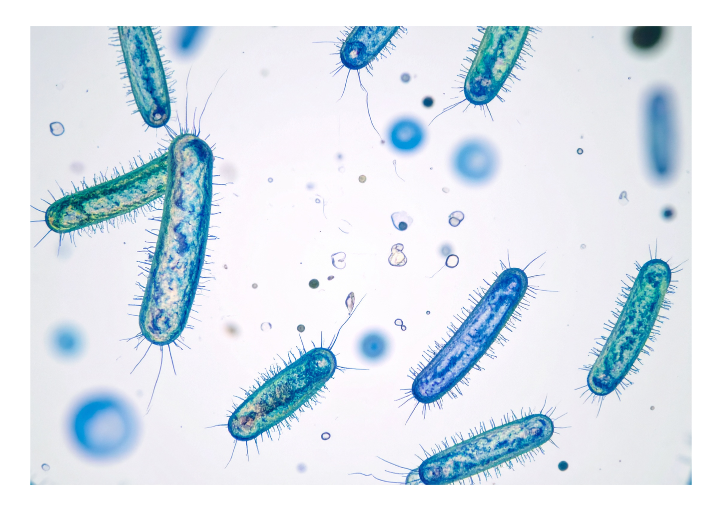 Dybiosis decoded (LVS25)