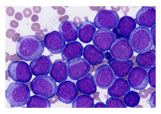 Contactless antimicrobial - a revolution in ophthalmology technology (LVS25)