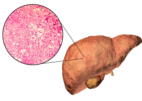 How to diagnose liver disease in practice  (BVA Live 2025)