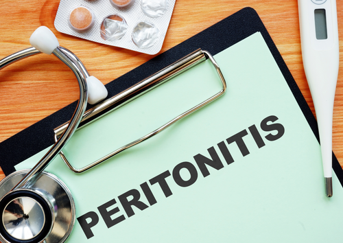 Feline infectious peritonitis: Approach to diagnosis  (BVA Live 2025)