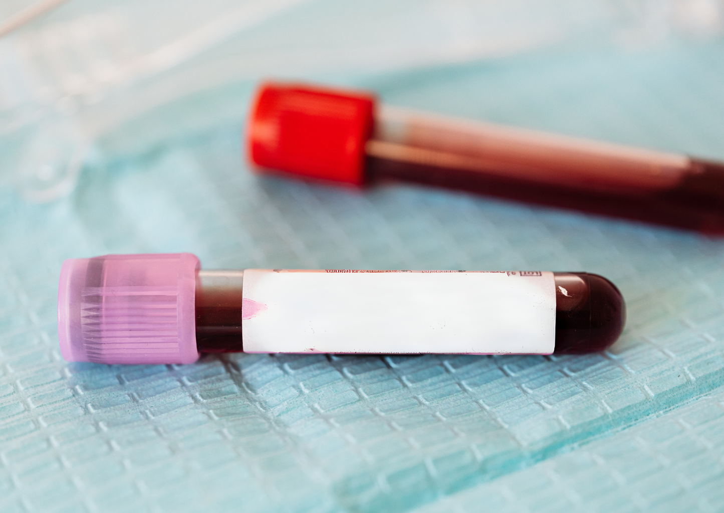 Teamwork in action: Blood transfusions - before, during and after (LVS25)
