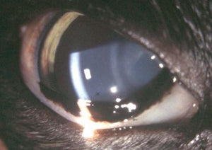 Under Pressure: Uveitis and Glaucoma