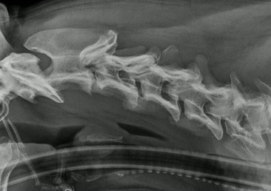 Douleur névropathique : comment diagnostiquer & se débrouiller