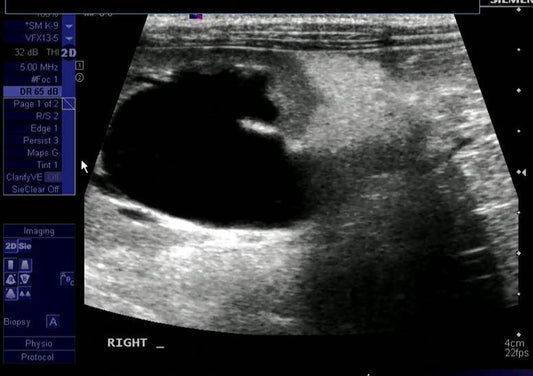 Intermediate/Advanced Ultrasound Pre-Lab Lecture