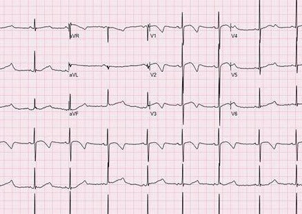 洋書 CARDIAC ARRHYTHMIAS in Dogs and Cats Cardiac arrhythmias in cats and dogs: 250 commented clinical