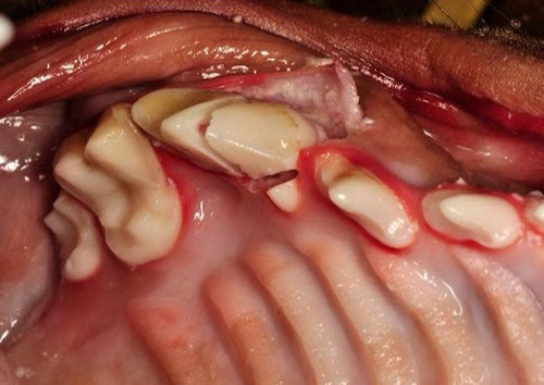 N’ont pas le temps de la douleur: la prévention et le traitement des complications d’extraction dentaire