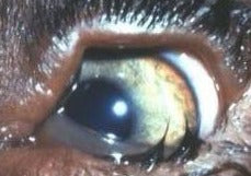 Beyond Scratches: Your Essential Guide to Corneal Ulceration