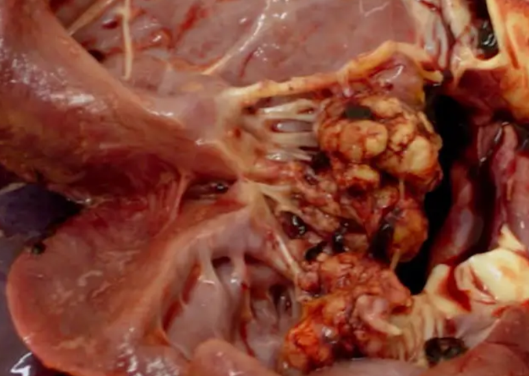 Diseases to Look Out For