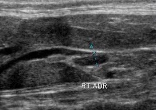 Small Mammal Imaging and Radiographic Cases