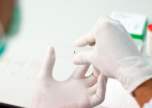 Bloody business; Getting to grips with blood film examination