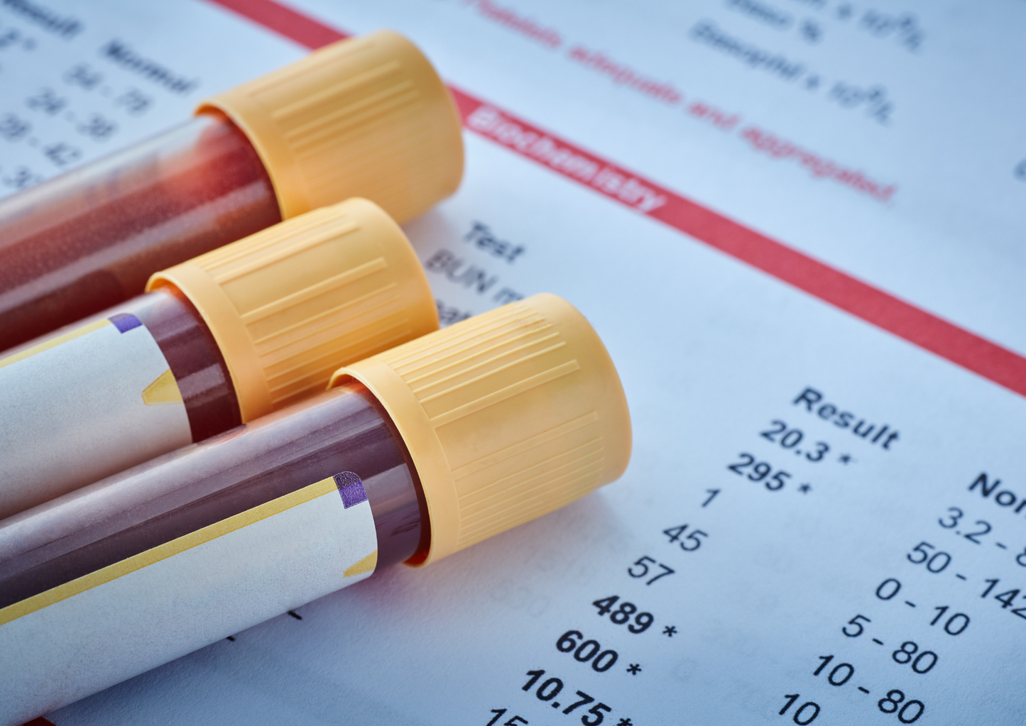 Early detection can save lives: what you need to know about cancer screening with a simple blood test