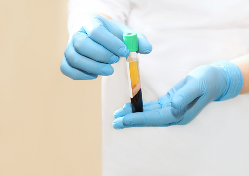 Regenerative medicine in veterinary first opinion practice. Platelet rich plasma overview and clinical cases.