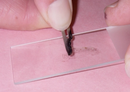 Dermatology Diagnostic Test - How to be Better