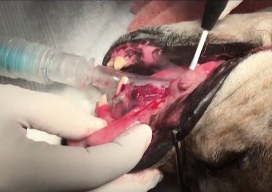 Lumps, Bumps and Other Things in Surgery - Energized Surgical Instruments in the OR