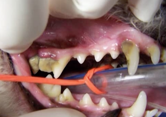 La maladie de Periodontal - contre quoi nous tous luttons