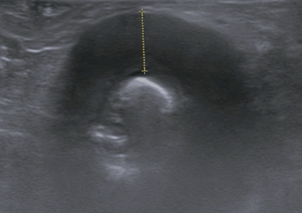 Blood and Guts - Assessment of the Patient with GI Bleeding