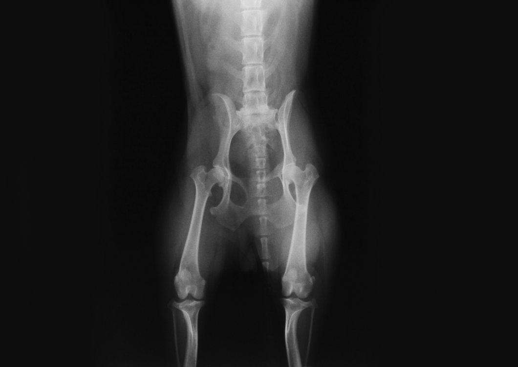 Opening Pandora's box: pelvic fractures and their management