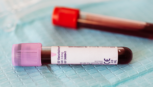 Screening bloodwork - the benefits and risks