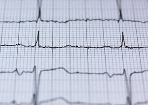 Finding a good rhythm - ECG interpretation