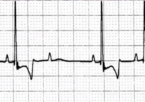 ECG Interpretation Workshop (Part 2)
