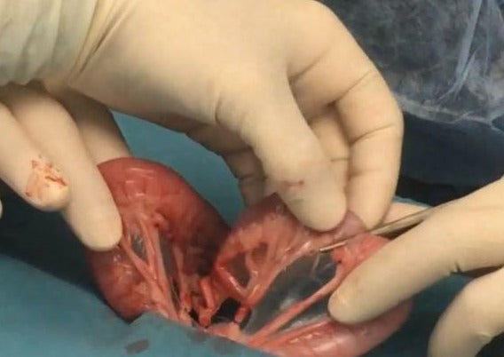 La Chirurgie Gastro-Intestinale - Les Gestes A Faire Et A Eviter