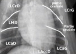 Je sais lire une radiographie du thorax
