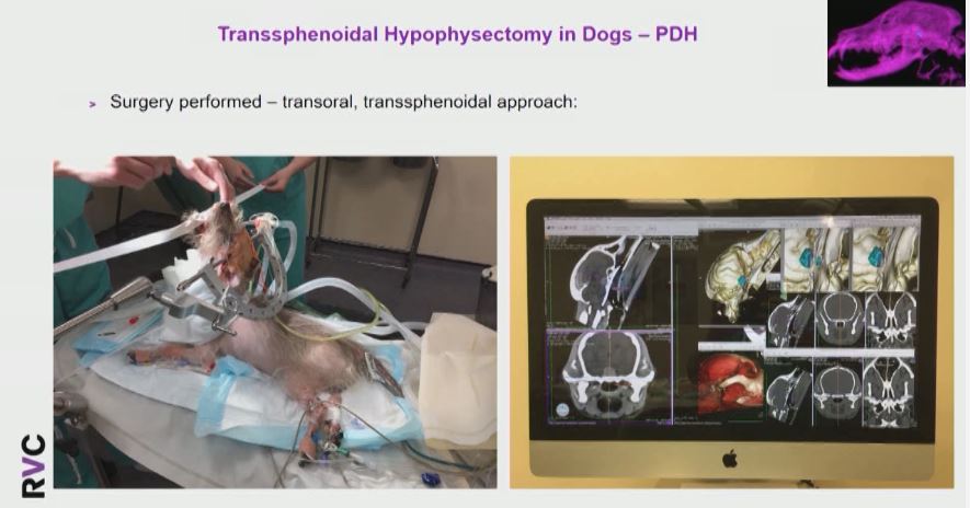 Le passé, le présent et l’avenir : progrès en cardiochirurgie et neurochirurgie qui sauvent maintenant des vies