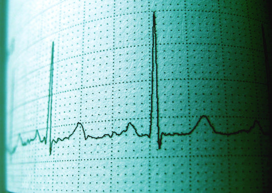 Ride the Wave: ECG Survival Kit