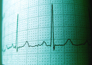 Montez la vague : kit de survie d'ECG